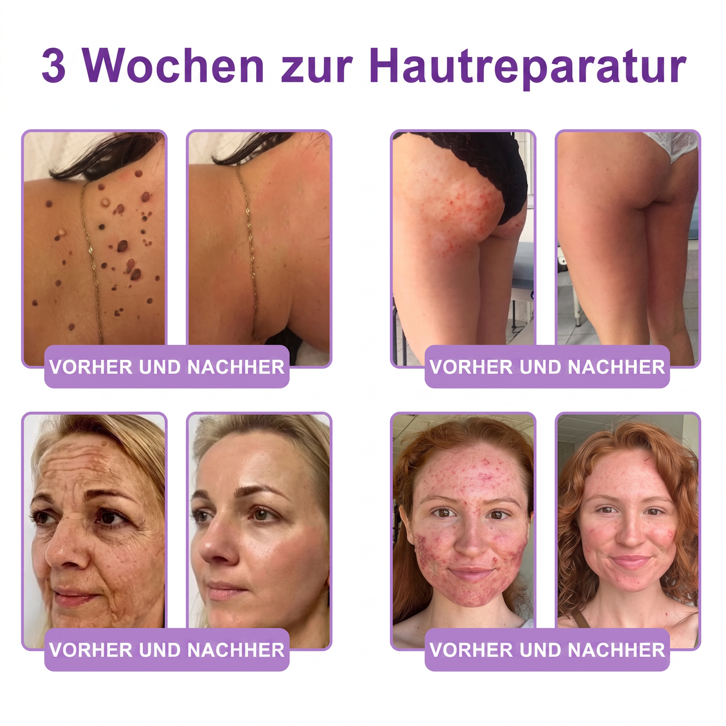 Vitalisys® PDRN 🌥️Multi-Peptid Körpercreme mit Massage-Roller – Feuchtigkeit, Straffung und ein ebenmäßigeres Hautbild.🥼