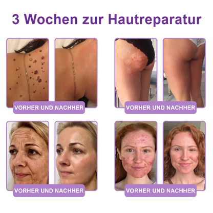Vitalisys® PDRN 🌥️Multi-Peptid Körpercreme mit Massage-Roller – Feuchtigkeit, Straffung und ein ebenmäßigeres Hautbild.🥼