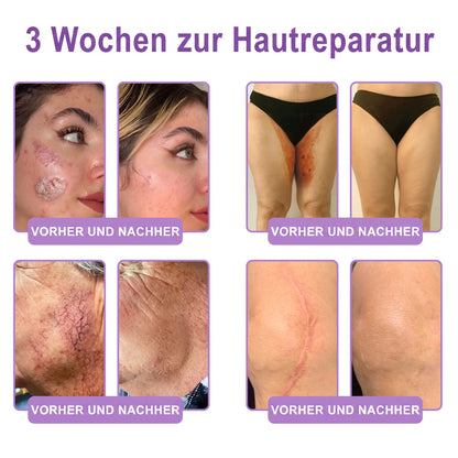 Vitalisys® PDRN 🌥️Multi-Peptid Körpercreme mit Massage-Roller – Feuchtigkeit, Straffung und ein ebenmäßigeres Hautbild.🥼