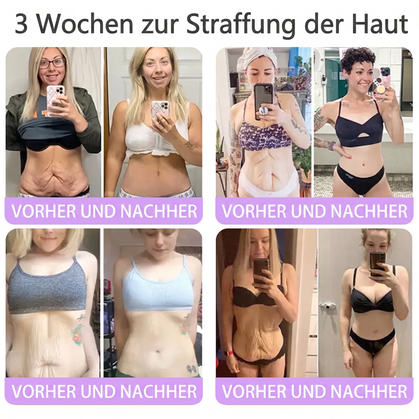 Vitalisys® PDRN 🌥️Multi-Peptid Körpercreme mit Massage-Roller – Feuchtigkeit, Straffung und ein ebenmäßigeres Hautbild.🥼