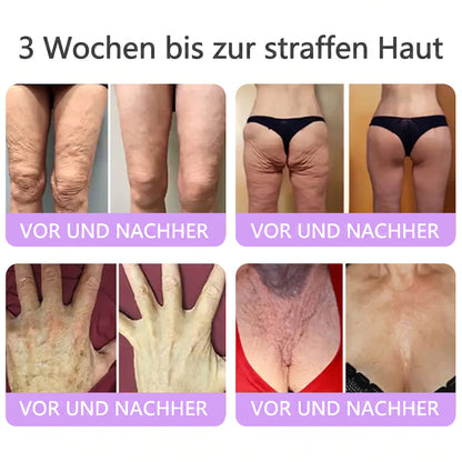 Vitalisys® PDRN 🌥️Multi-Peptid Körpercreme mit Massage-Roller – Feuchtigkeit, Straffung und ein ebenmäßigeres Hautbild.🥼