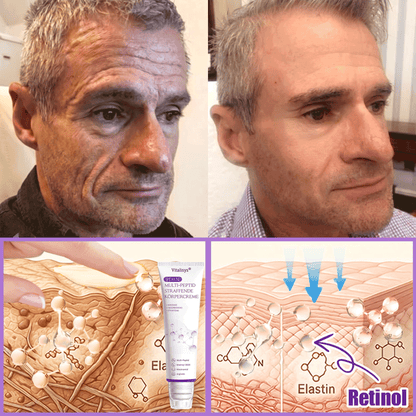 Vitalisys® PDRN 🌥️Multi-Peptid Körpercreme mit Massage-Roller – Feuchtigkeit, Straffung und ein ebenmäßigeres Hautbild.🥼