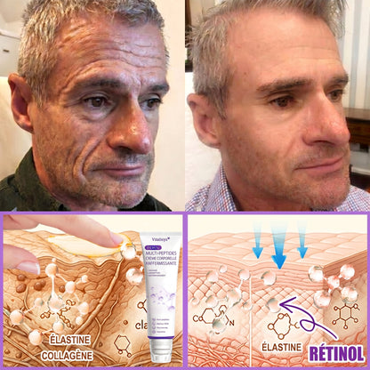 30 % RABATT🎁✨ Vitalisys® PDRN Multi-Peptid Körpercreme mit Massage-Roller – Feuchtigkeit, Straffung und ein ebenmäßigeres Hautbild.