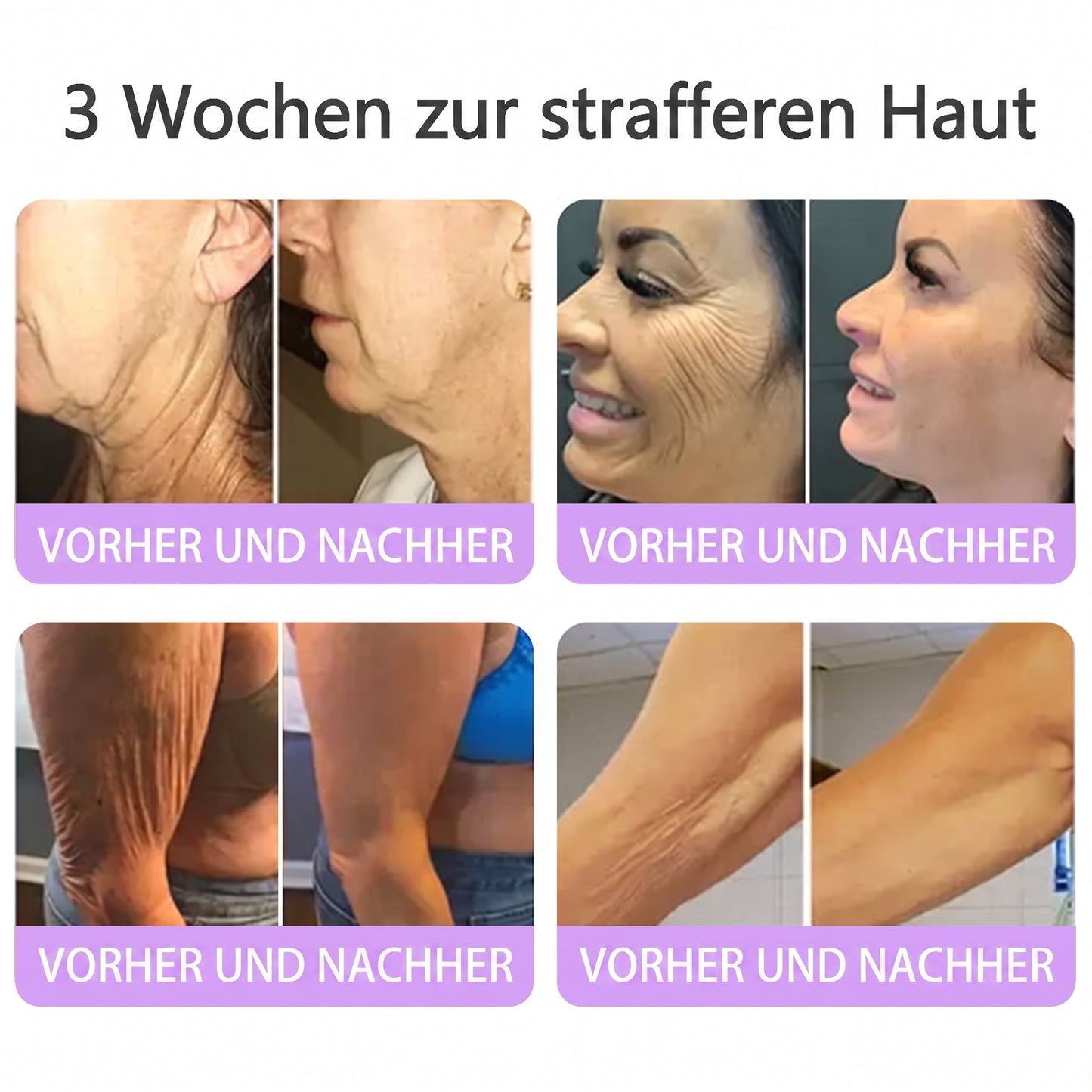 Vitalisys® PDRN 🌥️Multi-Peptid Körpercreme mit Massage-Roller – Feuchtigkeit, Straffung und ein ebenmäßigeres Hautbild.🥼